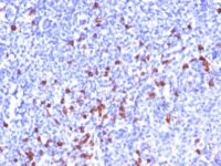 Formalin-fixed, paraffin embedded human tonsil sections stained with 100 ul anti-Kappa Light Chain (clone SPM508) at 1:50. HIER epitope retrieval prior to staining was performed in 10mM Citrate, pH 6.0.